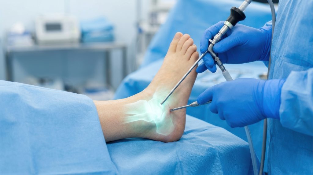 arthroskopische operation eines fußes